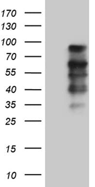 ELL / MEN Antibody (aa302-621, clone OTI5E12)