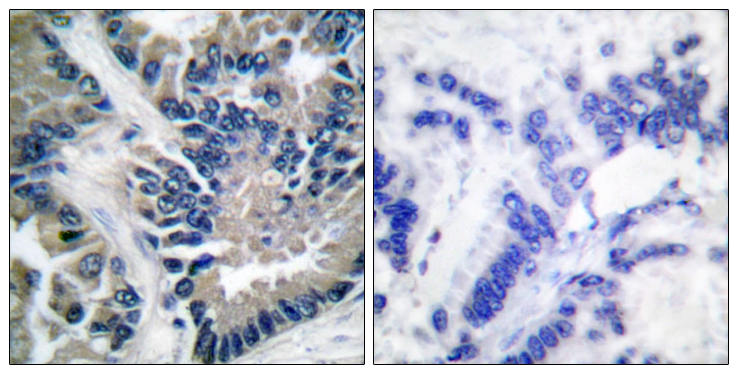 STAT2 Antibody (aa656-705)