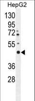 Polyclonal Rabbit anti-Human LRTM2 Antibody (aa339-367, IHC, IF, WB)