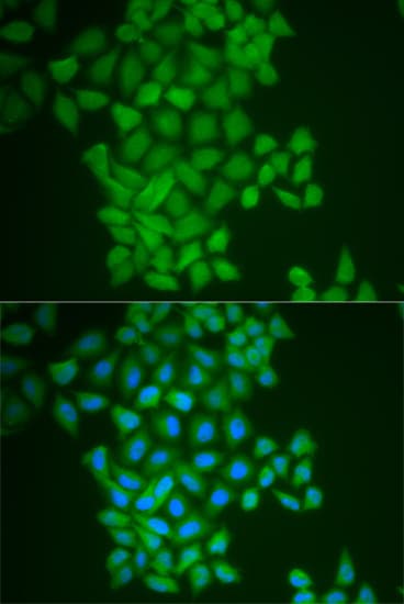 Polyclonal Rabbit anti-Human FTH1 / Ferritin Heavy Chain Antibody (IHC, IF, WB)
