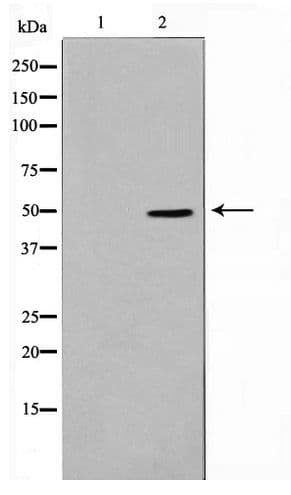 F2R / Thrombin Receptor / PAR1 Antibody