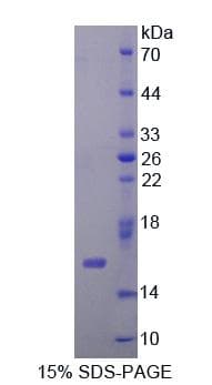 Human MYCBP Protein (Recombinant His-T7)