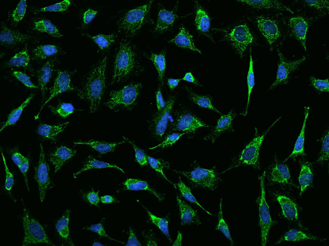 AK4 / Adenylate Kinase 4 Antibody