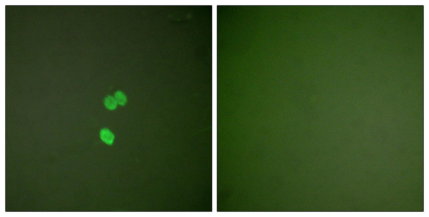 LGALS3 / Galectin 3 Antibody