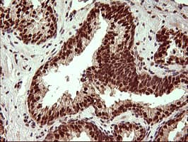 UPRT Antibody (clone OTI2F2)