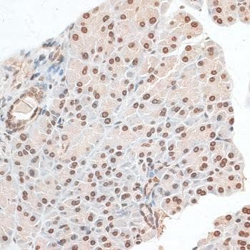 ZNF177 / PIGX Antibody