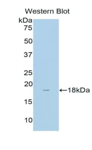 CD118 / LIF Receptor Alpha Antibody (aa152-291, APC)