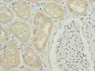 Polyclonal Rabbit anti-Human GGTLA4 / GGTLC1 Antibody (IHC)