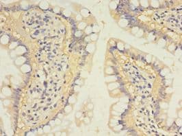 SULT1B1 / Sulfotransferase 1B1 Antibody (aa1-271)