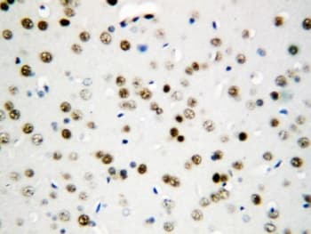 API5 Antibody (aa487-504)