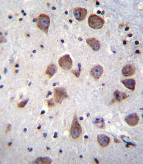Polyclonal Rabbit anti-Human PDE1B Antibody (aa473-500, IHC, WB)