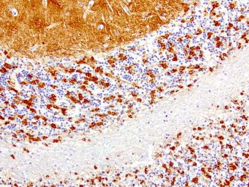 SYP / Synaptophysin Antibody (clone UMAB112)