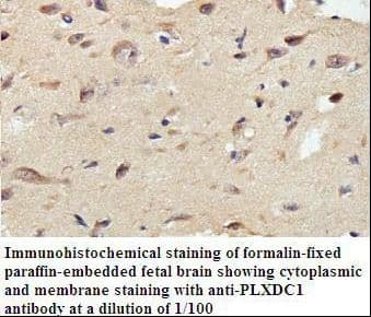 TEM7 Antibody (aa198-387)
