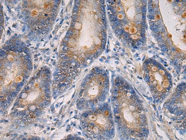 Polyclonal Rabbit anti-Human MAPKAPK3 Antibody (IHC)