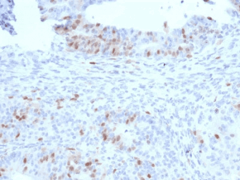 RAD51 / RECA Antibody (clone RAD51/2701)