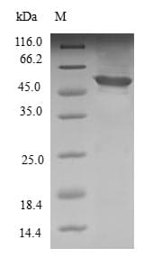 Human APIP Protein (Recombinant GST, N-terminus)