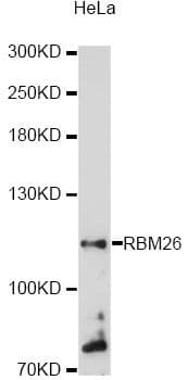 RBM26 / SE70 Antibody