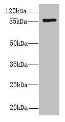 FSCB Antibody