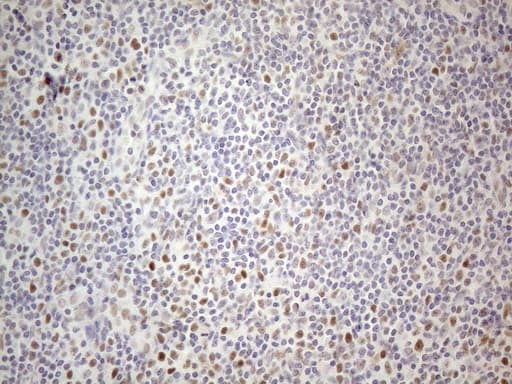 TDG / Thymine DNA Glycosylase Antibody (aa160-253, clone OTI3C11)