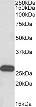 IHC-plus™ Polyclonal Goat anti-Human HOXC6 Antibody (aa22-36, IHC, WB)