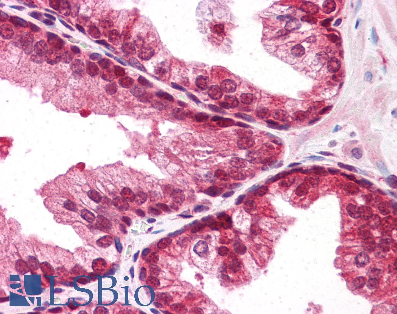 Polyclonal Rabbit anti-Human SUMO2 + SUMO3 Antibody (IHC, IF, WB)