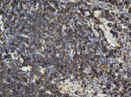CD20 Antibody (clone OTI4A4)