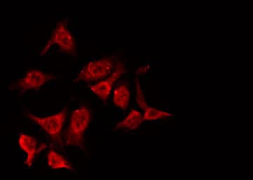 NPM1 / NPM / Nucleophosmin Antibody