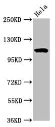 NAT10 Antibody