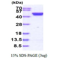 Human CSNK2A1 Protein (Recombinant His)