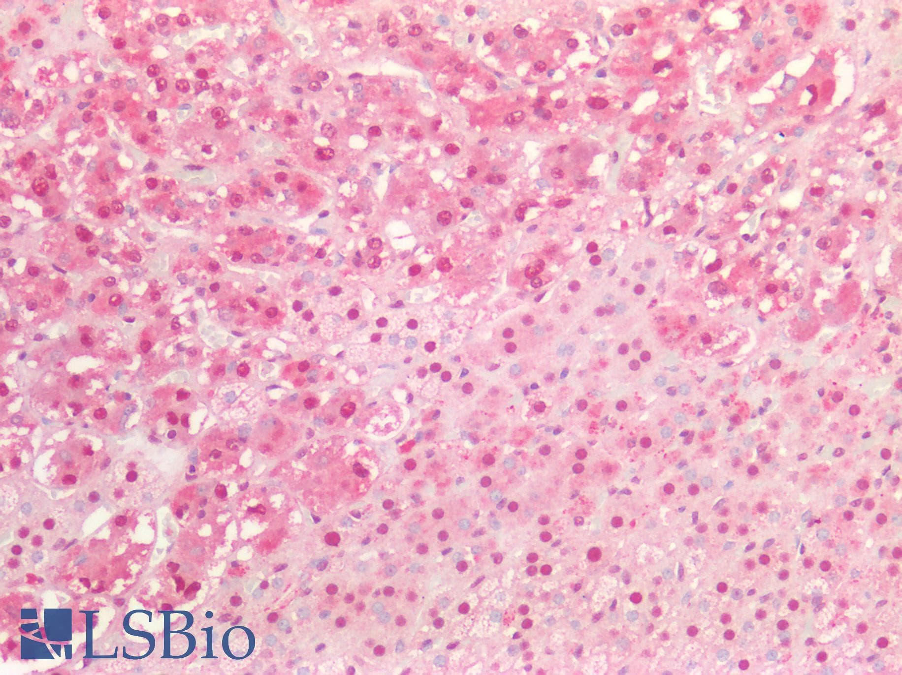 PathPlus™ Polyclonal Rabbit anti-Human MYC / c-Myc Antibody (IHC)