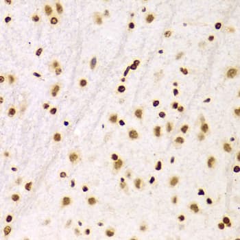 Polyclonal Rabbit anti-Human Histone H3 Antibody (IHC, IF, WB)
