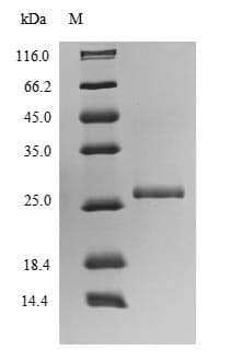 Human UL131 Protein (Recombinant 6His-SUMO, N-terminus)