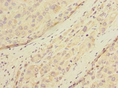 POMGNT1 Antibody