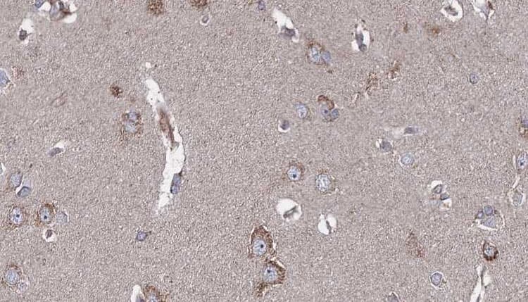 Polyclonal Rabbit anti-Human SRPX Antibody (IHC, WB)