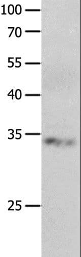 PathPlus™ RBFOX3 / NEUN Antibody