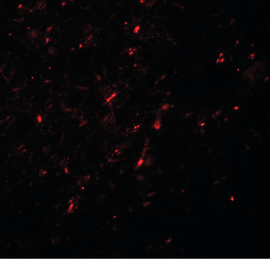 IHC-plus™ Polyclonal Rabbit anti-Human NEUROG2 / NGN2 / Neurogenin 2 Antibody (IHC, IF, WB)