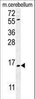 ANKRD39 Antibody (aa137-165)