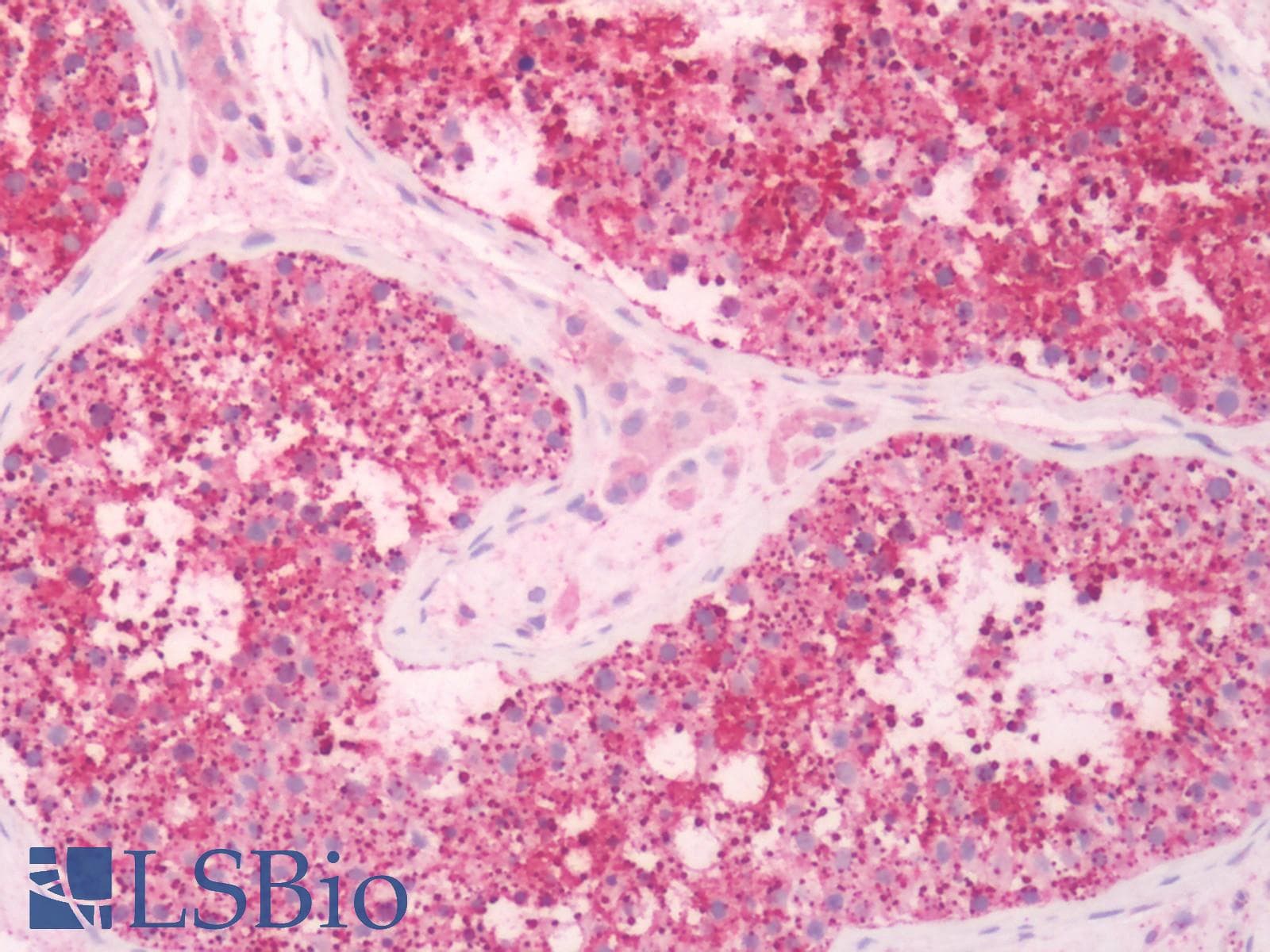 IHC-plus™ KISS1R / GPR54 Antibody (Extracellular Domain)