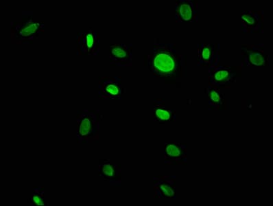 CACYBP Antibody