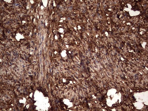LGALS3 / Galectin 3 Antibody (clone OTI6E1, Carrier-free)