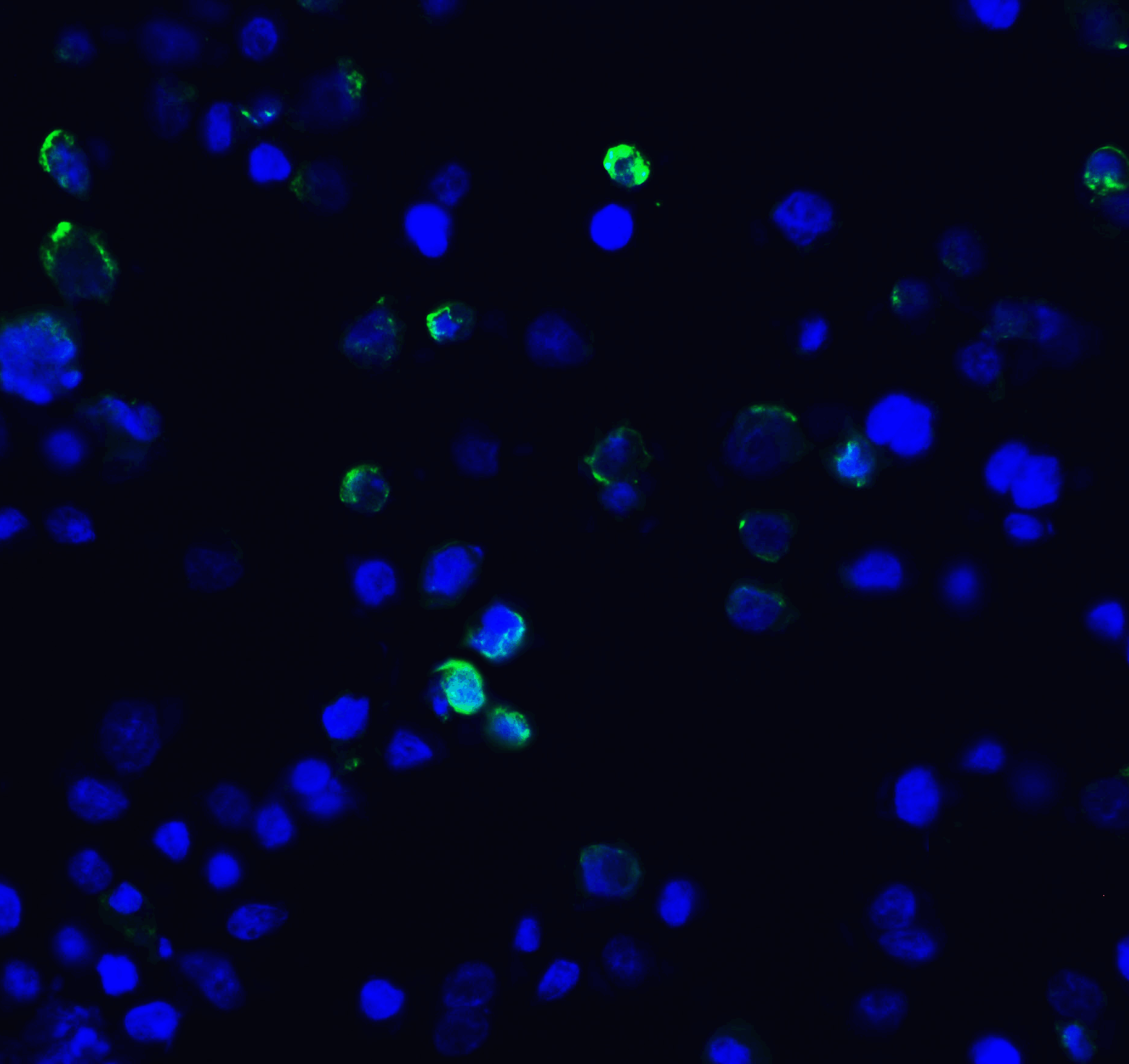 Monoclonal Mouse anti-Human HAVCR2 / TIM-3 Antibody (clone 10C10, IHC, IF, WB)