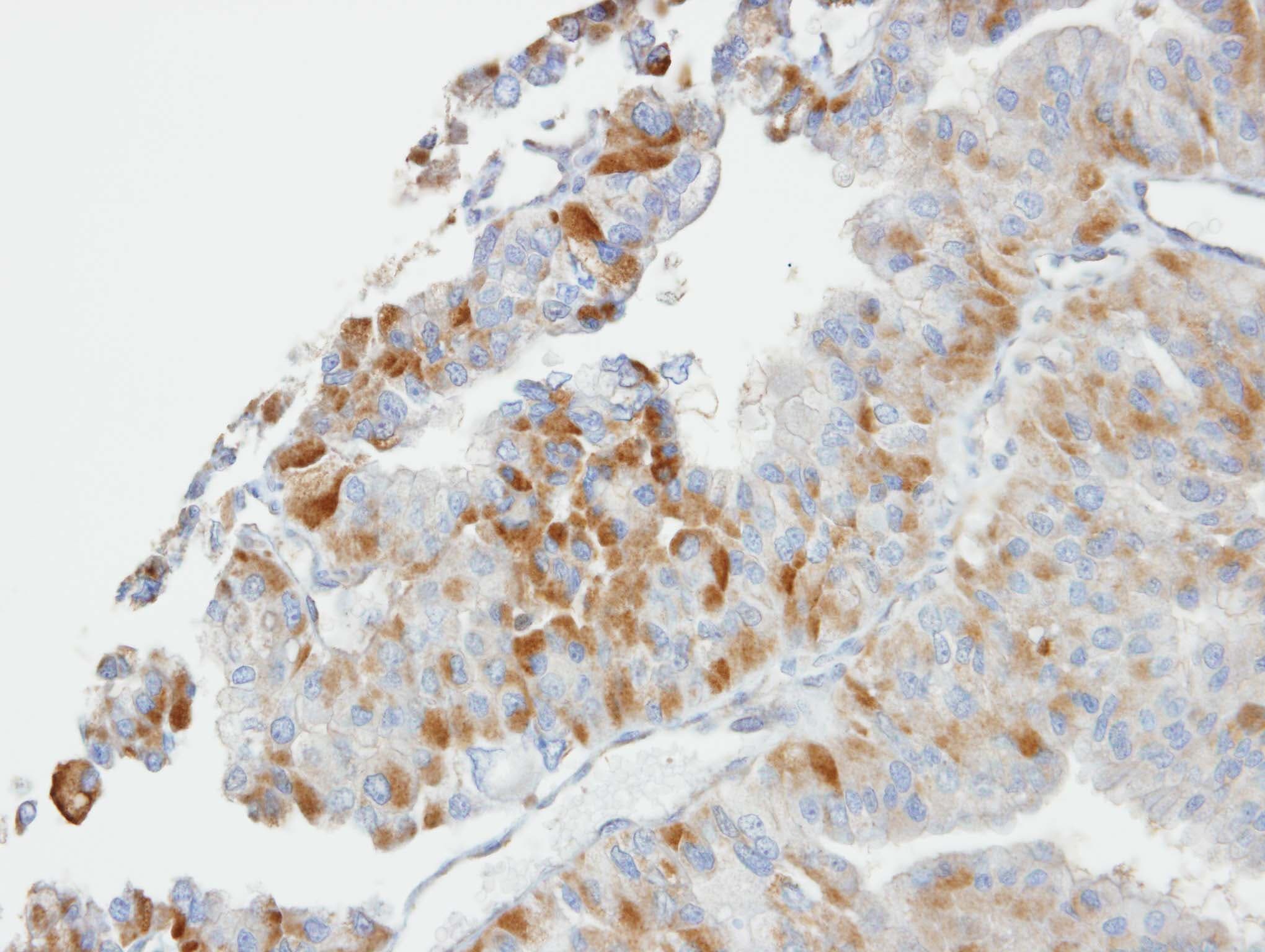 Polyclonal Rabbit anti-Human GSTO1 Antibody (aa30-241, IHC, WB)