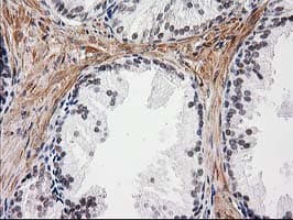 NNMT Antibody (clone OTI1A1)