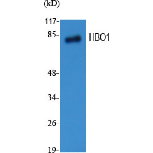 Polyclonal Rabbit anti-Human MYST2 / HBO1 Antibody (100-180 aa, Internal, IF, WB)