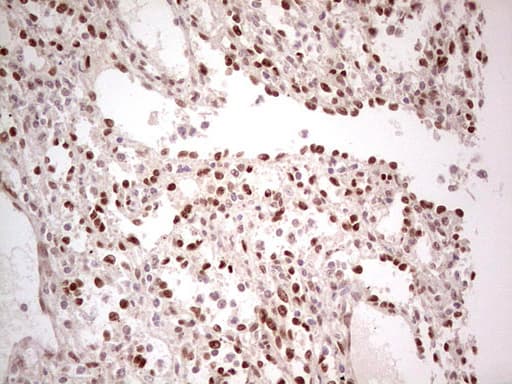 NR5A1 / SF1 Antibody (aa1-262, clone OTI1B4)