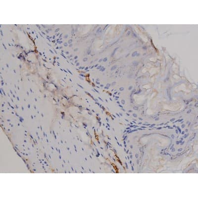 STAT6 Antibody (phospho-Tyr641)