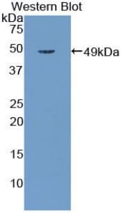 CST / GAL3ST1 Antibody (aa57-196)