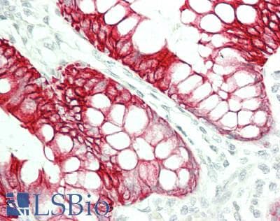 IHC-plus™ Acidic Cytokeratin Antibody (clone 1D10)