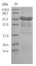 Human TLR10 Protein (Recombinant 10His-SUMO, N-terminus + Myc, C-terminus)