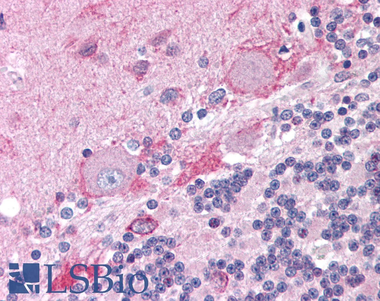 IHC-plus™ Polyclonal Rabbit anti-Human CNR1 / CB1 Antibody (aa461-472, IHC, WB)